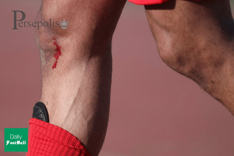 مصدومیت شهریار مغانلو در بازی دوستانه پرسپولیس و سایپا