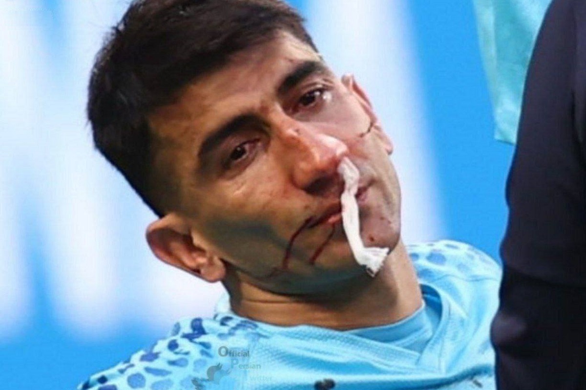 احتمال ضربه مغزی علیرضا بیرانوند در پی مصدومیت در جام جهانی 2022