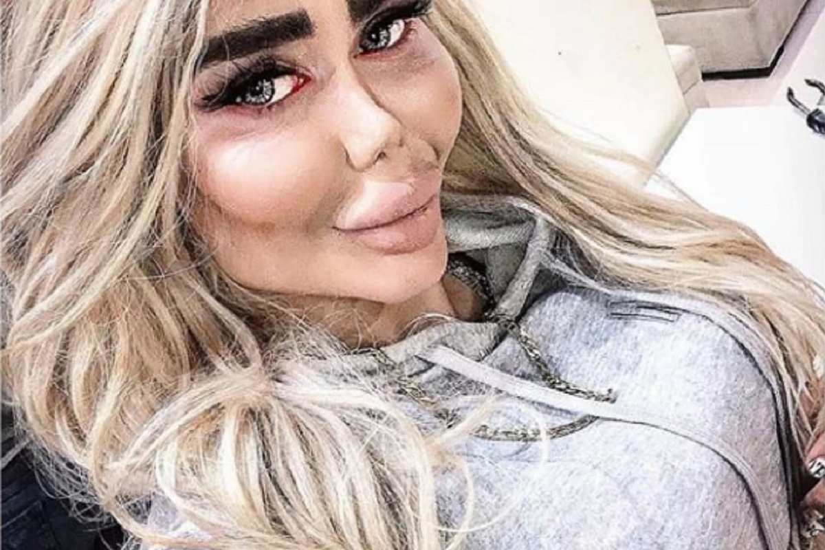 عکس| عاقبت کشف حجاب و هنجارشکنی فاطمه رجایی راد پزشک آملی