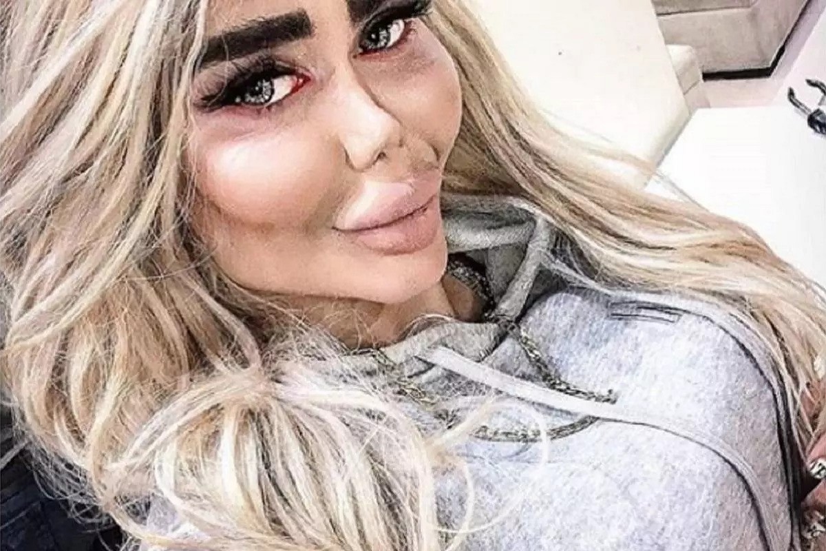 عکس| عاقبت بی حجابی و ترویج فحشا در اینستاگرام | دیلی فوتبال