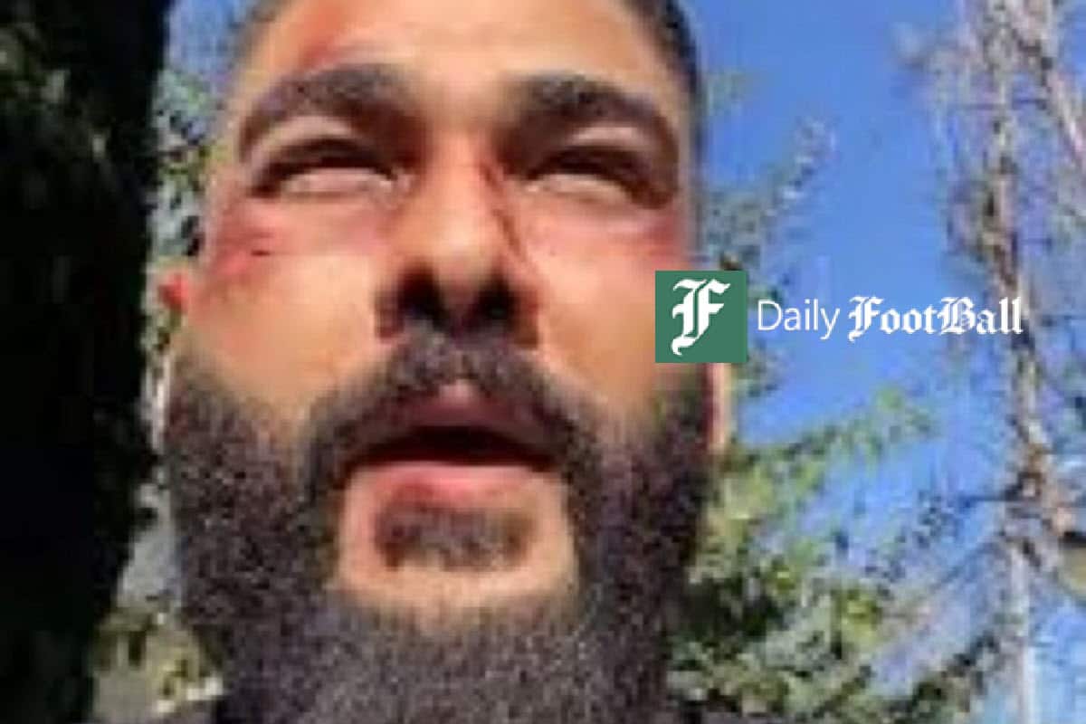 عکس| ضرب و شتم ساسی مانکن توسط نیروهای امنیتی ایران در عمان | دیلی فوتبال