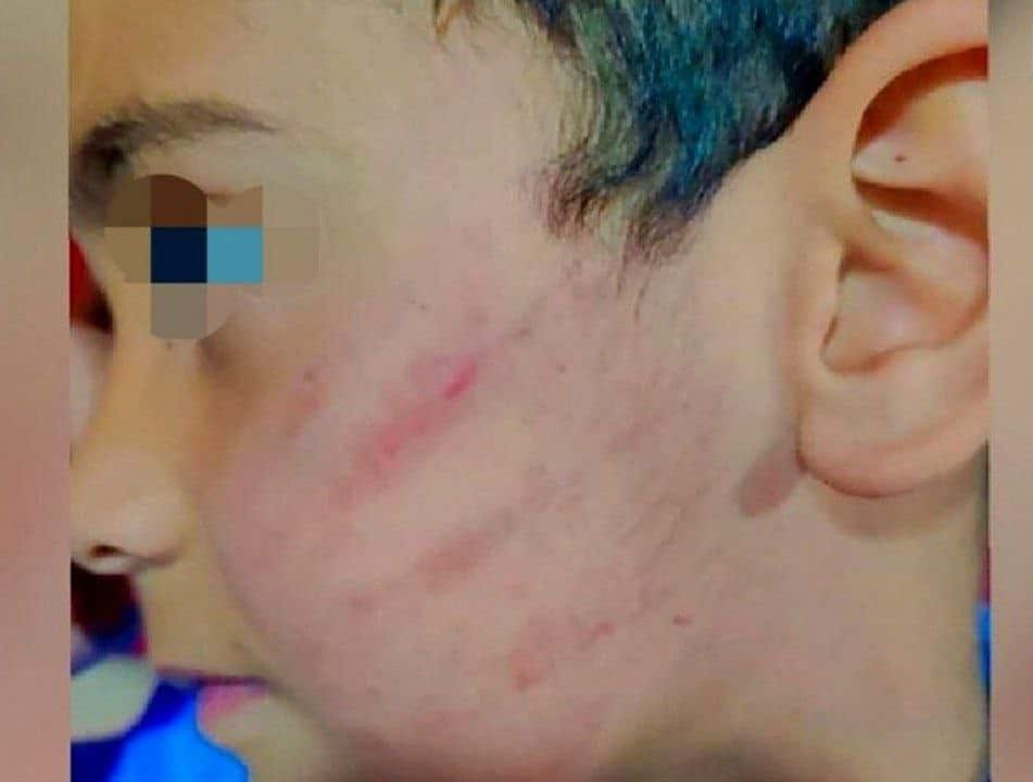 عکس| عاقبت کتک زدن دانش آموز کلاس اولی در سیستان و بلوچستان عکس| عاقبت کتک زدن دانش آموز کلاس اولی در سیستان و بلوچستان | دیلی فوتبال