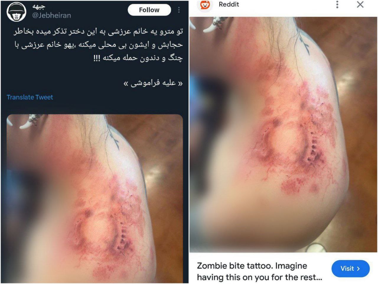 عکس| واقعیت ماجرای گاز گرفتن دختر بی حجاب توسط آمر به معروف در مترو عکس| واقعیت ماجرای گاز گرفتن دختر بی حجاب توسط آمر به معروف در مترو | دیلی فوتبال