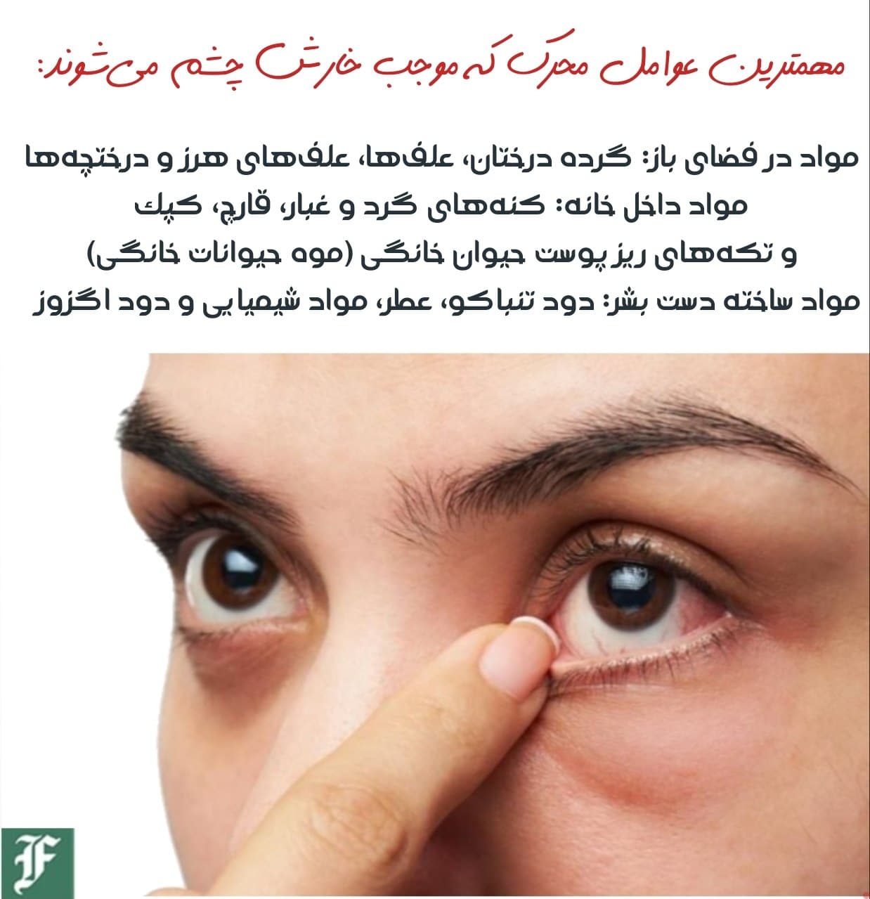 مهمترین علل خارش چشم و راه‌های درمان | دیلی فوتبال