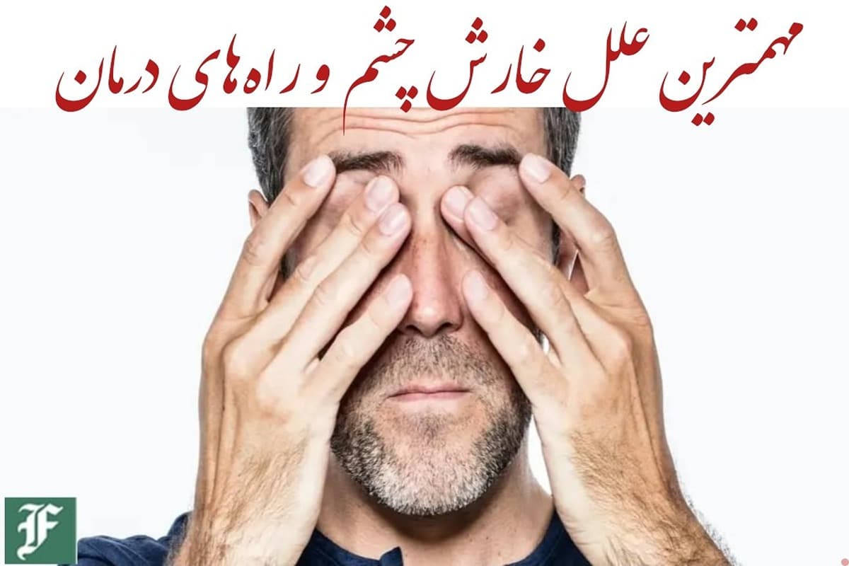 مهمترین علل خارش چشم و راه‌های درمان | دیلی فوتبال